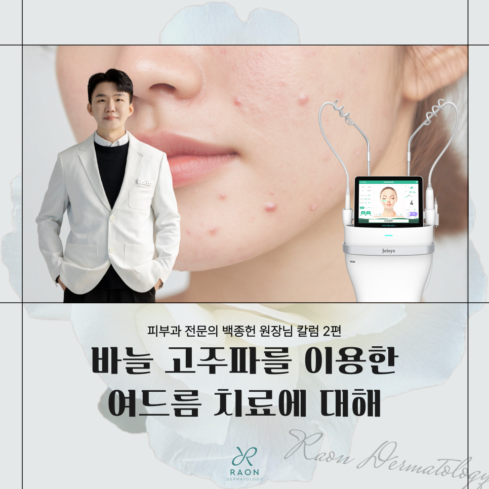 성동구 피부과 바늘 고주파 여드름 치료 이해하기 2편 [백종헌 원장 칼럼] 관련 이미지 1