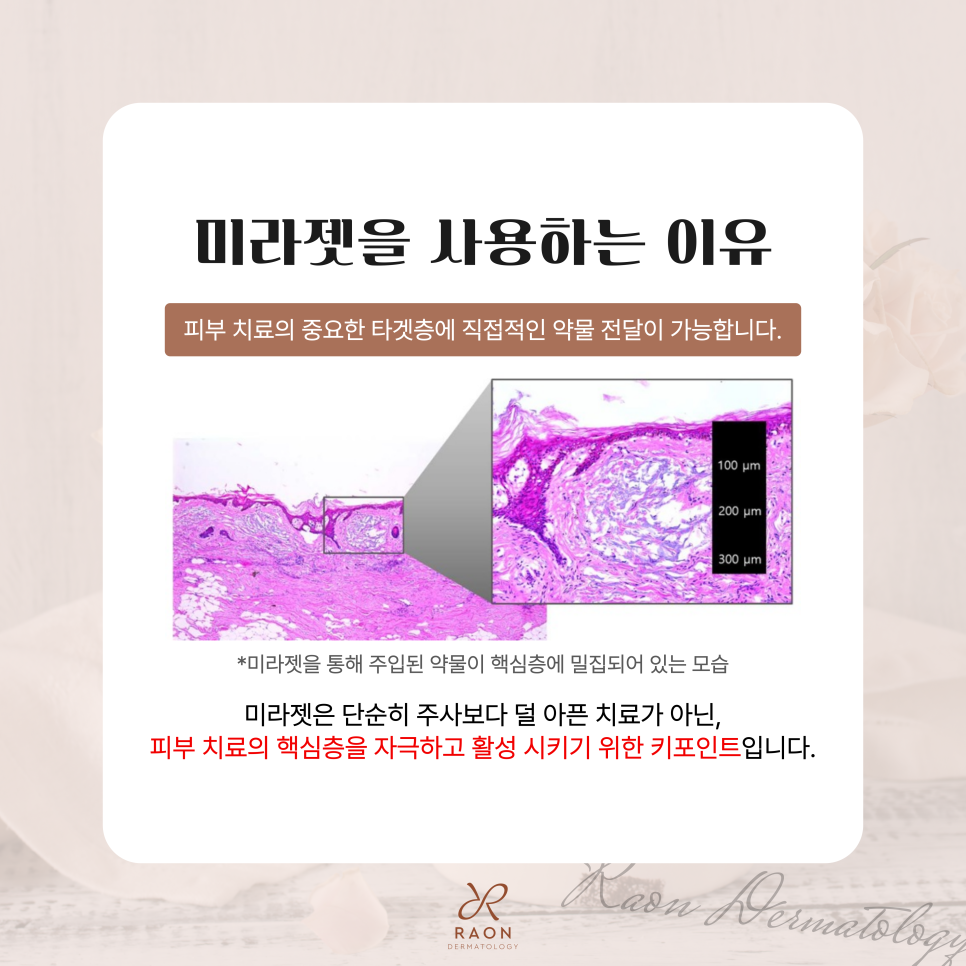 대표원장 피부칼럼｜왕십리 피부과 왜 미라젯일까? 원리와 효과에 대하여 관련 이미지 5