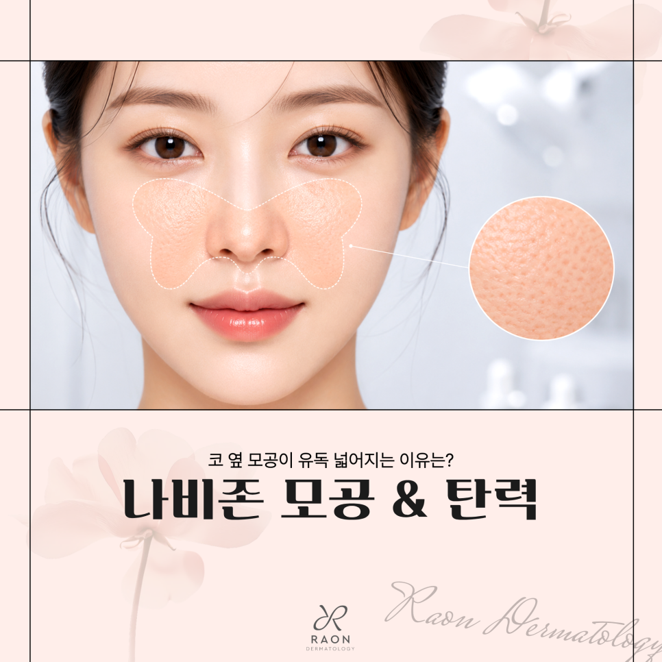 성동구 피부과 나비존 피부의 특징 이해하기, 리써FX와 펌핑팁 및 쥬베룩 조합 장점은? 관련 이미지 1