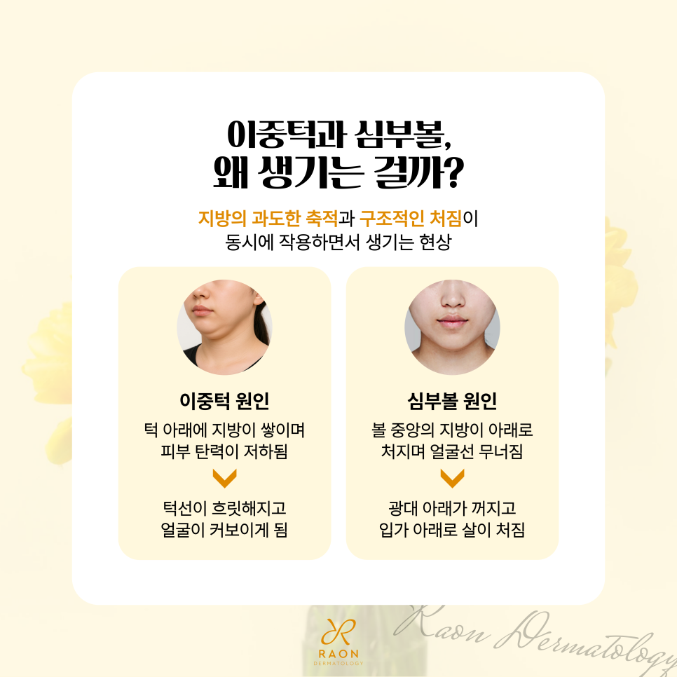턱 밑 살과 심부볼 고민, 성동구 피부과 이중턱 리프팅으로 개선하기 관련 이미지 2