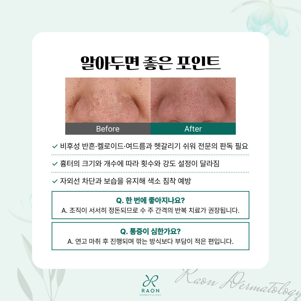 왕십리 피부과 포텐자 원니들 구진성 흉터 및 비후성 반흔 치료는 뭐가 다를까? 관련 이미지 6