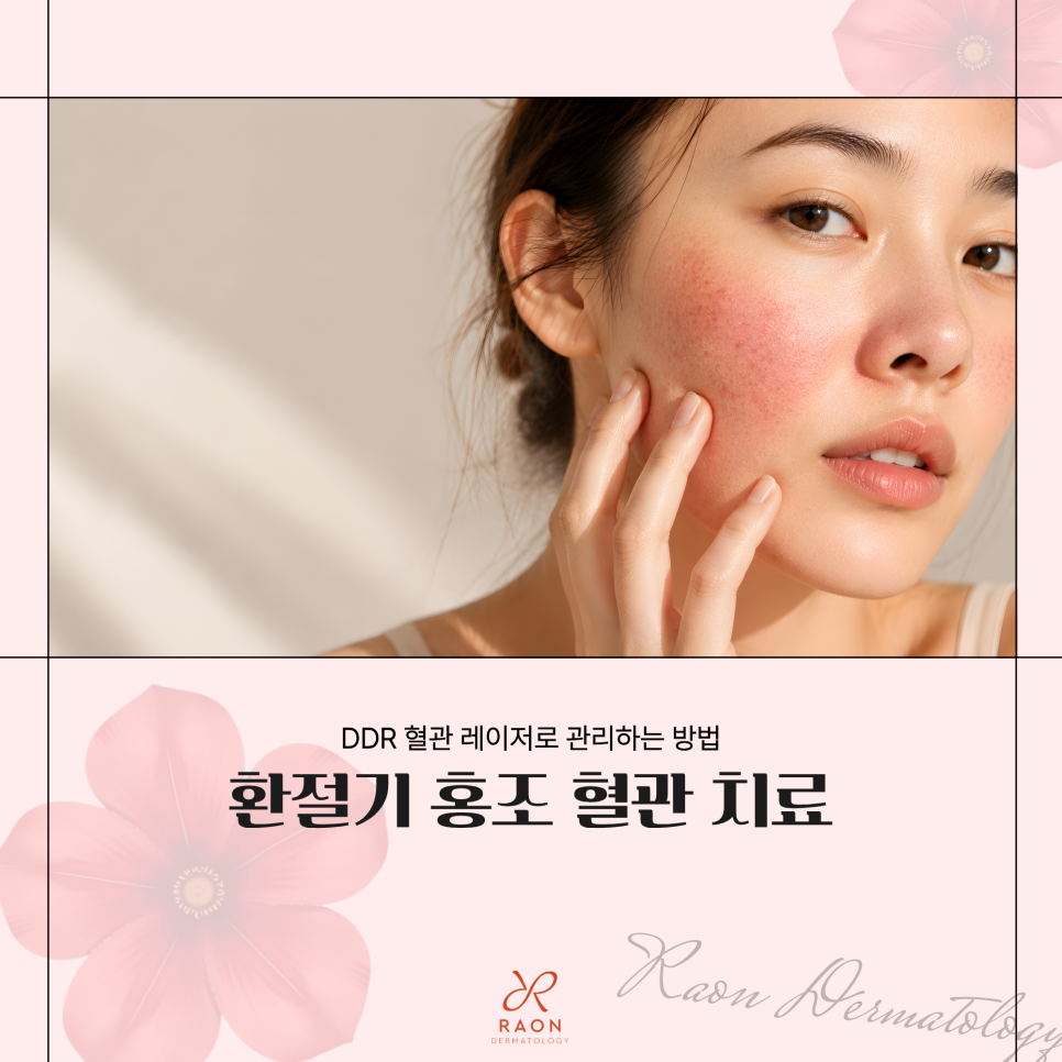 성동구 피부과 전문의 환절기 홍조는 DDR 혈관 레이저로, 적정 치료 주기는? 관련 이미지 1