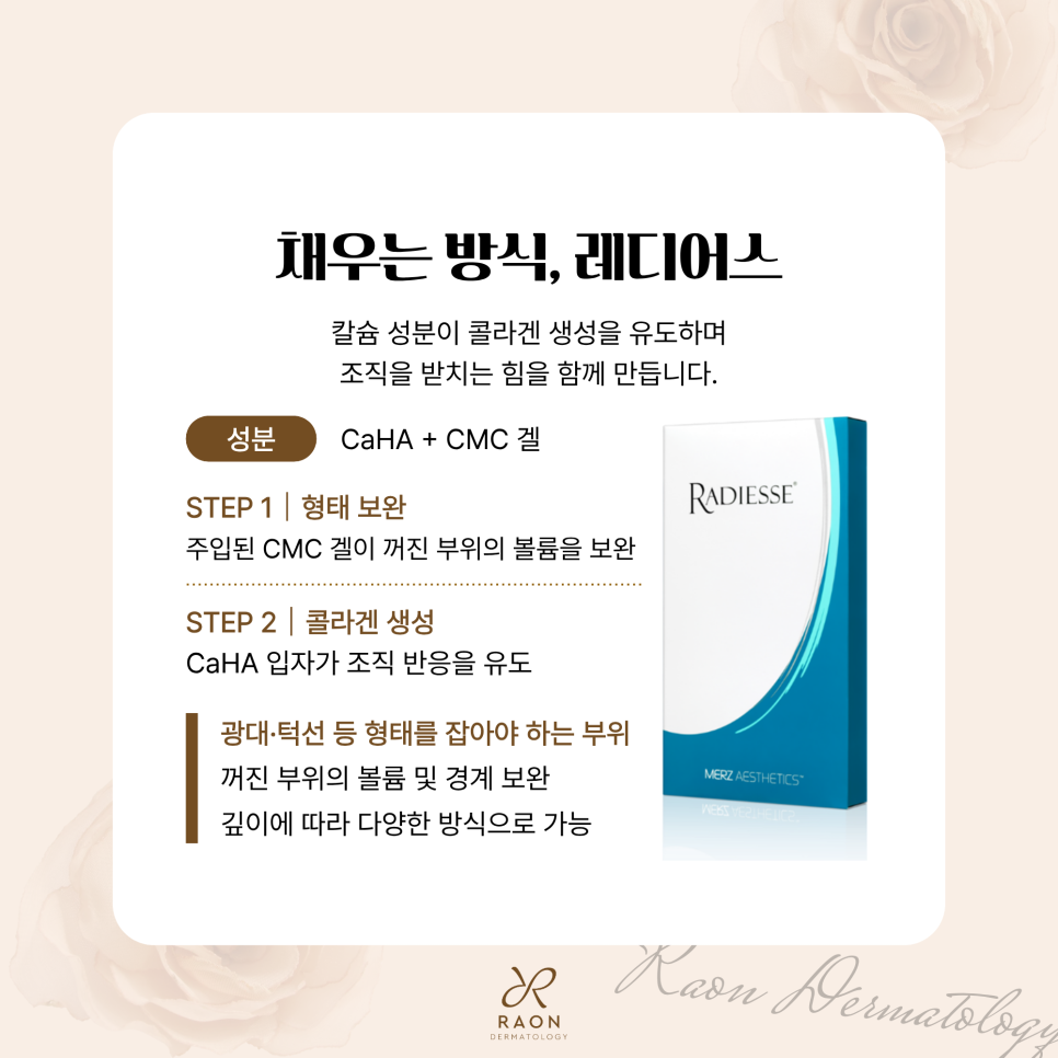 Seongdong-gu Dermatology: A Collapsed Facial Contour—How About Combining Ultherapy and Radiesse? image 5