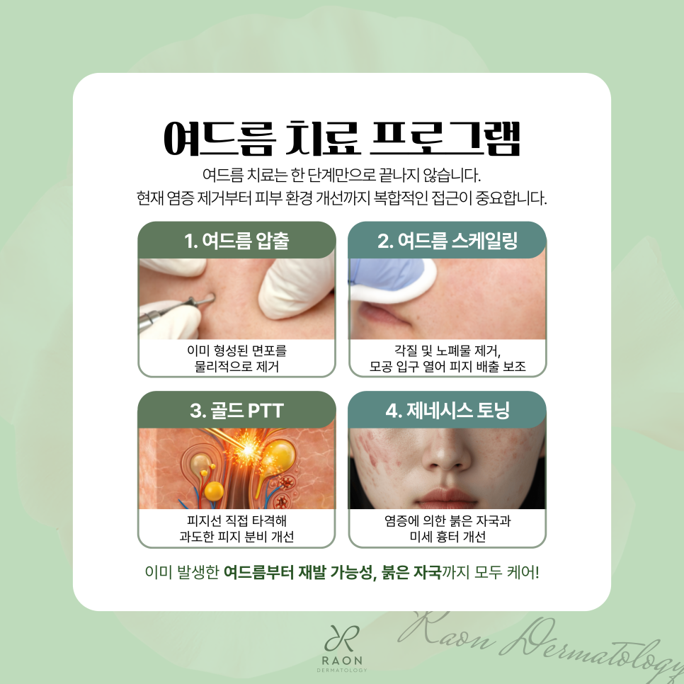 Wangsimni Dermatology Clinic: Looking at the Full Process from Acne Extraction to Gold PTT and Genesis Toning image 2