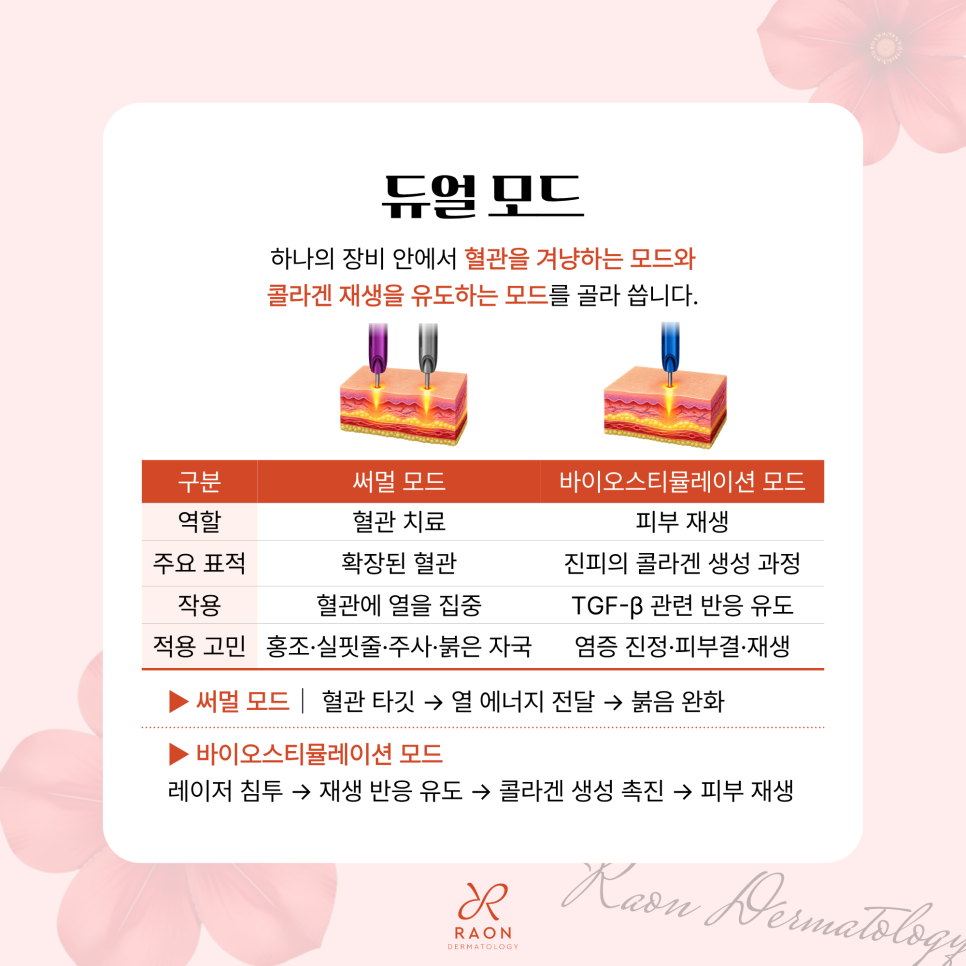 성동구 피부과 전문의 환절기 홍조는 DDR 혈관 레이저로, 적정 치료 주기는? 관련 이미지 4