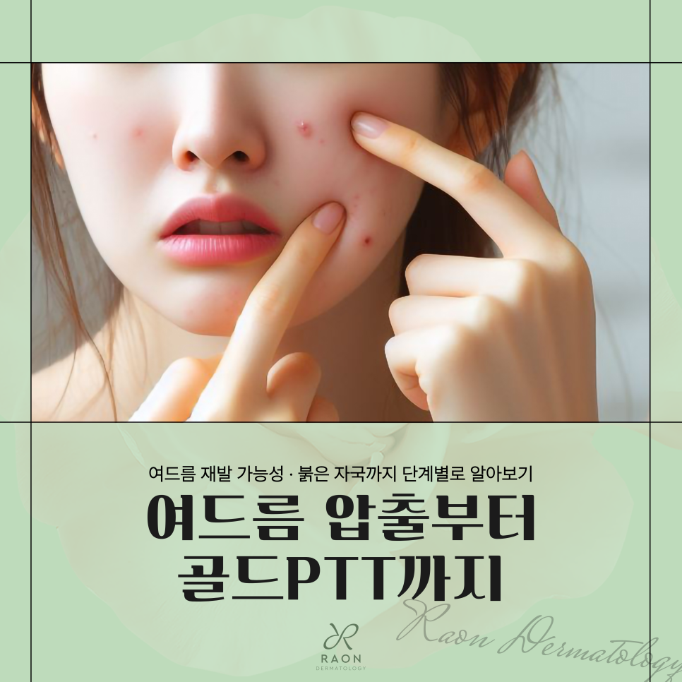 Wangsimni Dermatology Clinic: Looking at the Full Process from Acne Extraction to Gold PTT and Genesis Toning image 1