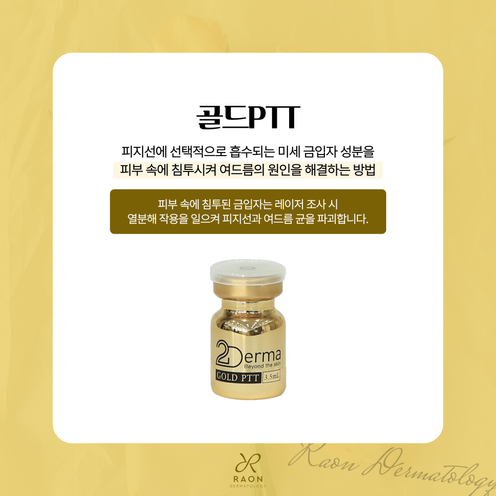 왕십리 피부과 전문의의 여드름 치료 골드PTT로 피지 억제 가능할까 관련 이미지 3