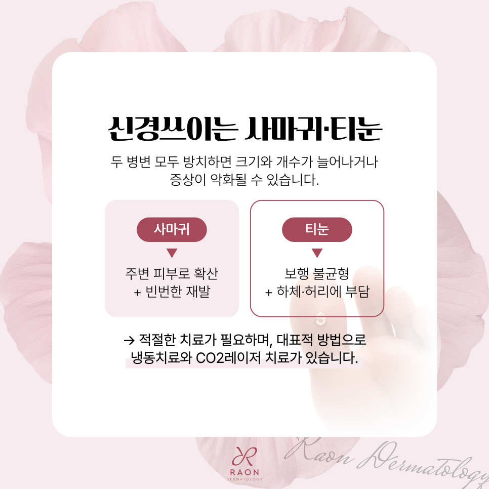 Improving Warts, Corns, and Other Epidermal Lesions with Cryotherapy and CO2 Laser at a Dermatology Clinic in Haengdang-dong image 4