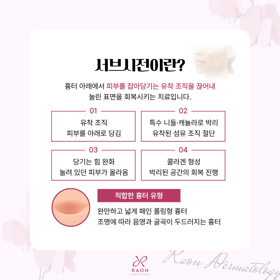 왕십리 피부과 여드름 흉터 도트필과 서브시전 피부과 전문의 치료가 필요한 이유? 관련 이미지 4