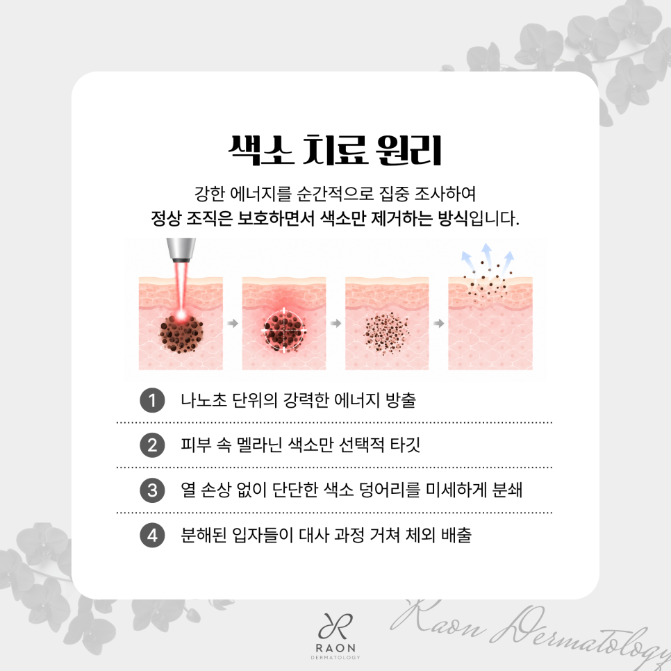 성동구 피부과 전문의 헐리우드 스펙트라 포함 듀얼 레이저 토닝 치료 가능한 색소는? 관련 이미지 3
