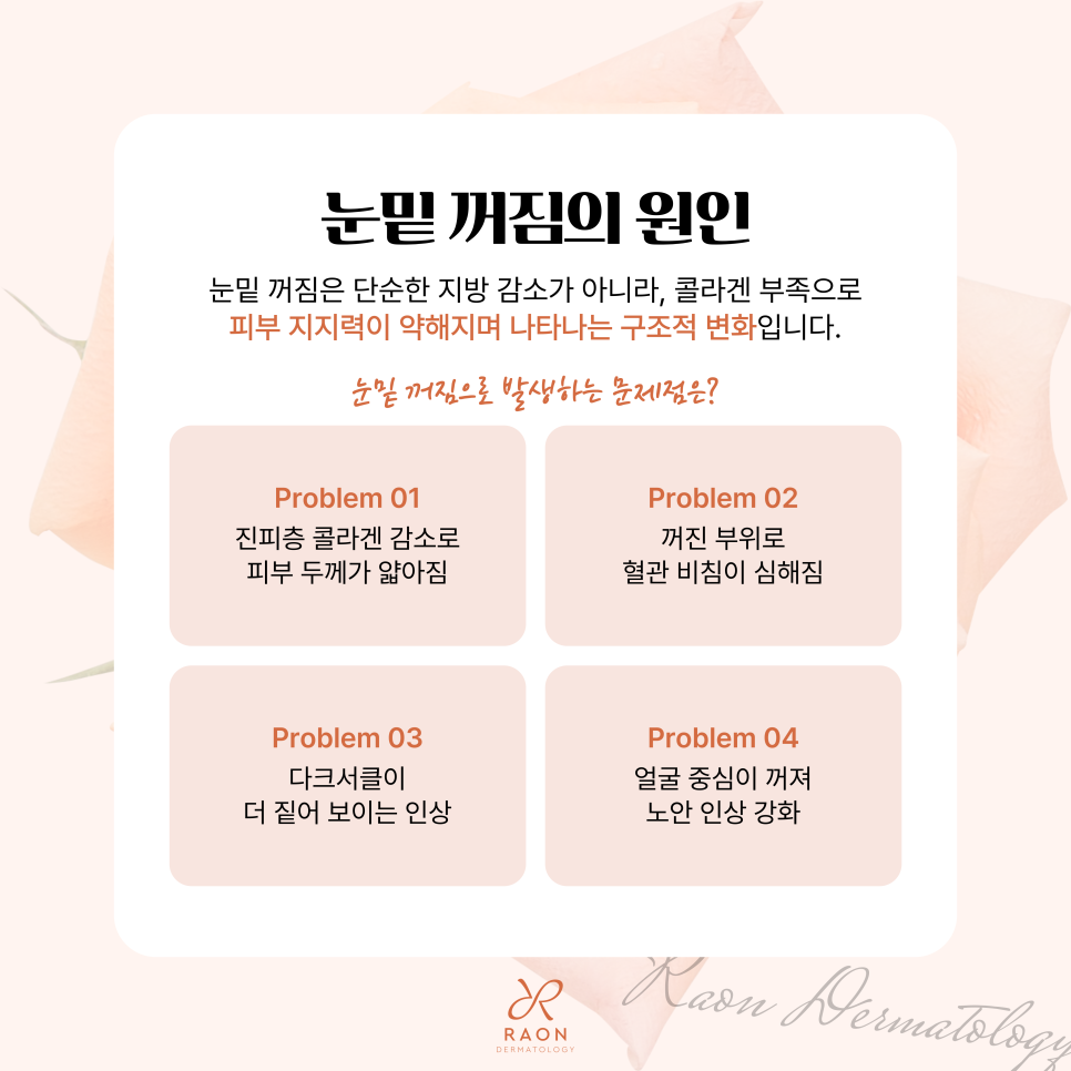 Wangsimni Dermatology: What Are the Effects of the Collagen Booster Retigen for Under-Eye Hollowing and Regeneration? image 2