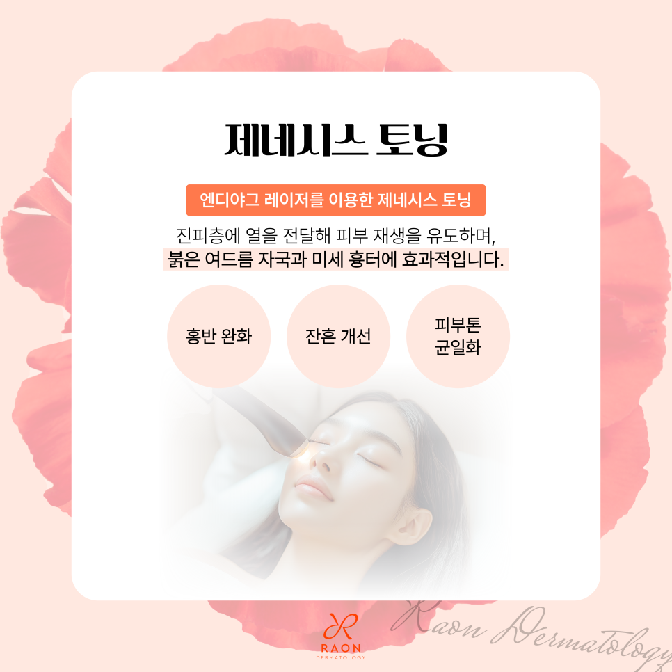 잊을만하면 올라오는 여드름? 재발까지 고려한 성동구 피부과 여드름 치료 프로세스 관련 이미지 5