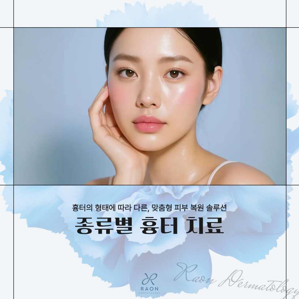 Hoehyeon Station Dermatology: Characteristics and Treatment Methods by Scar Type, and What Are the Benefits of Combining Mirajet and Juvelook? image 1