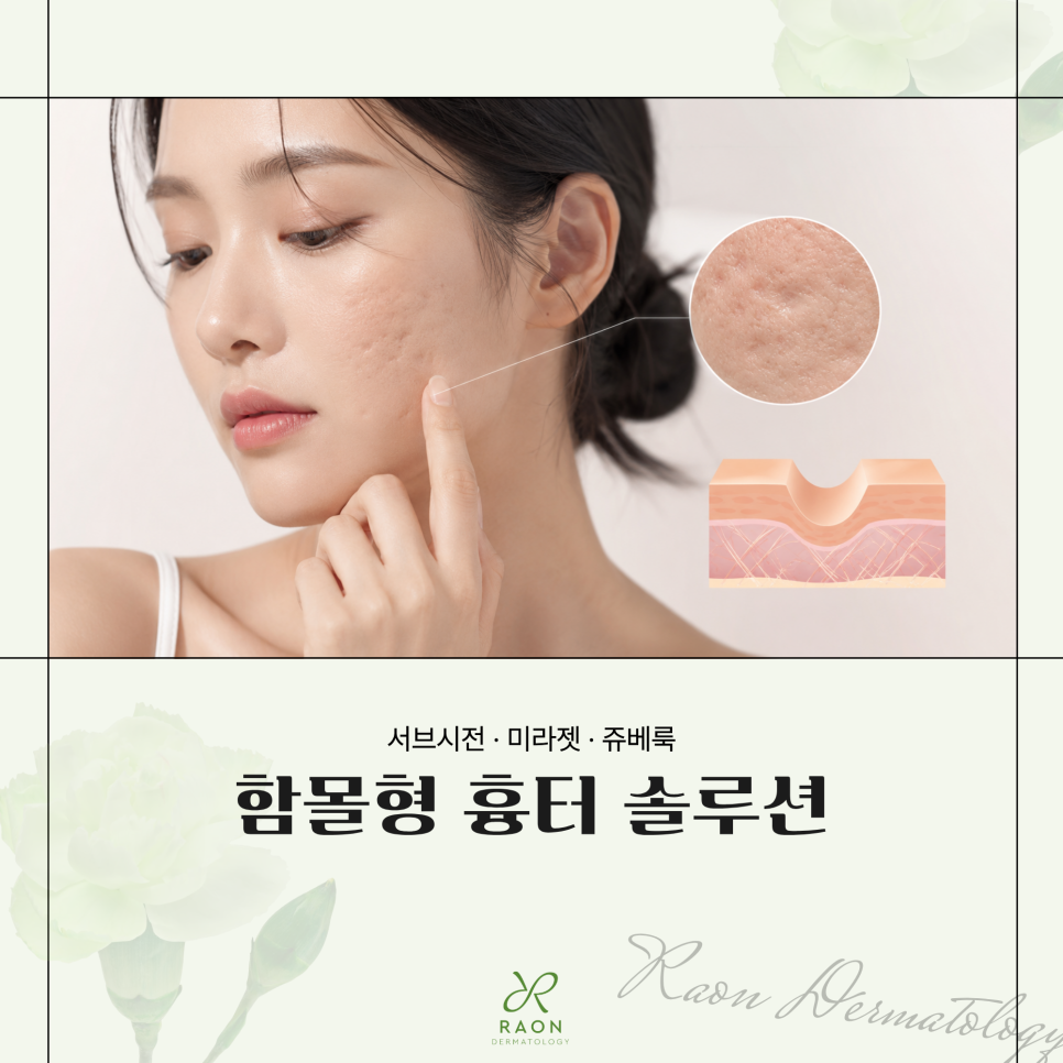 왕십리피부과 서브시전부터 미라젯, 쥬베룩까지 여러 여드름 흉터 치료법을 병행하면? 관련 이미지 1