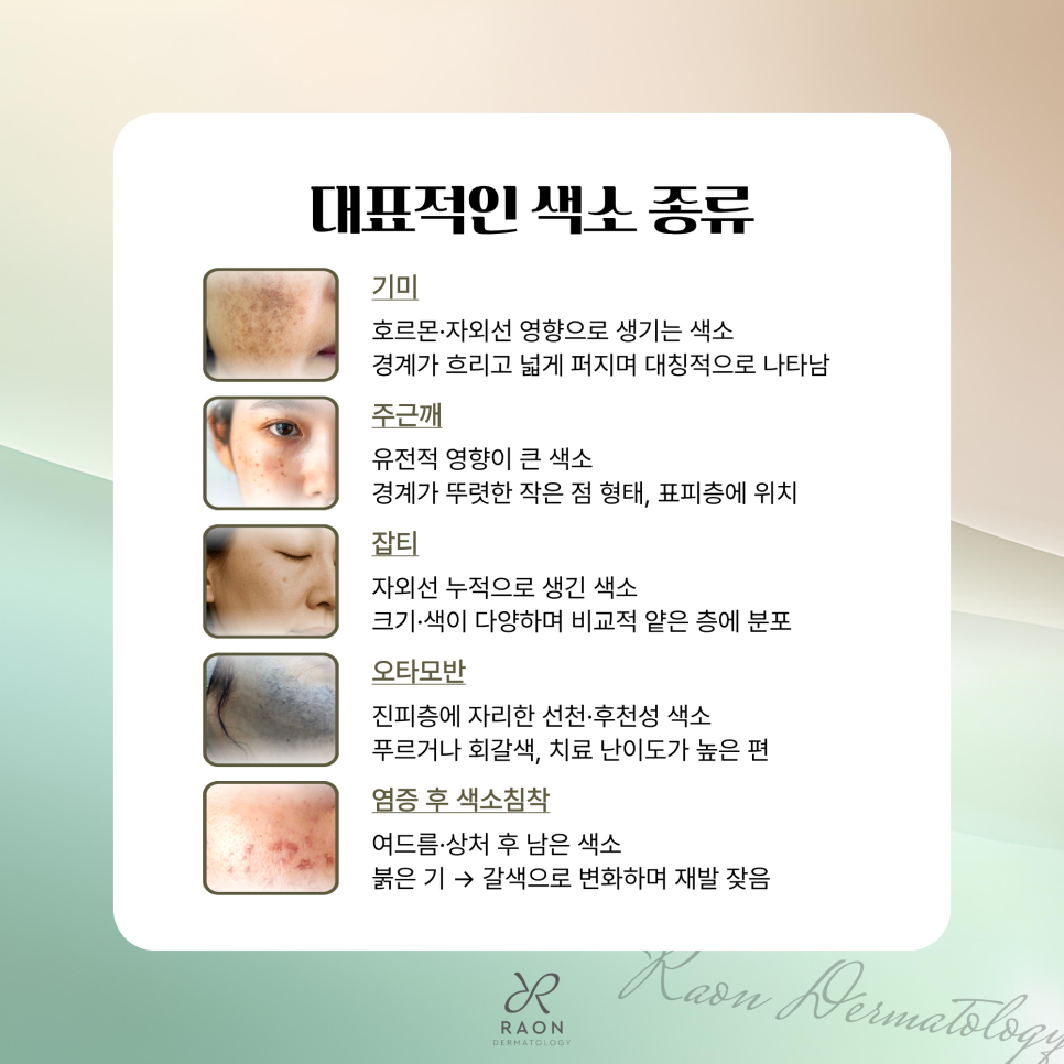 행당동 피부과 색소 치료 시 듀얼 토닝이 필요한 이유? 색소 치료에 대한 오해 관련 이미지 2