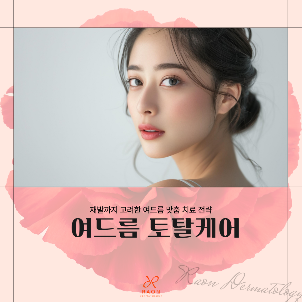 잊을만하면 올라오는 여드름? 재발까지 고려한 성동구 피부과 여드름 치료 프로세스 관련 이미지 1
