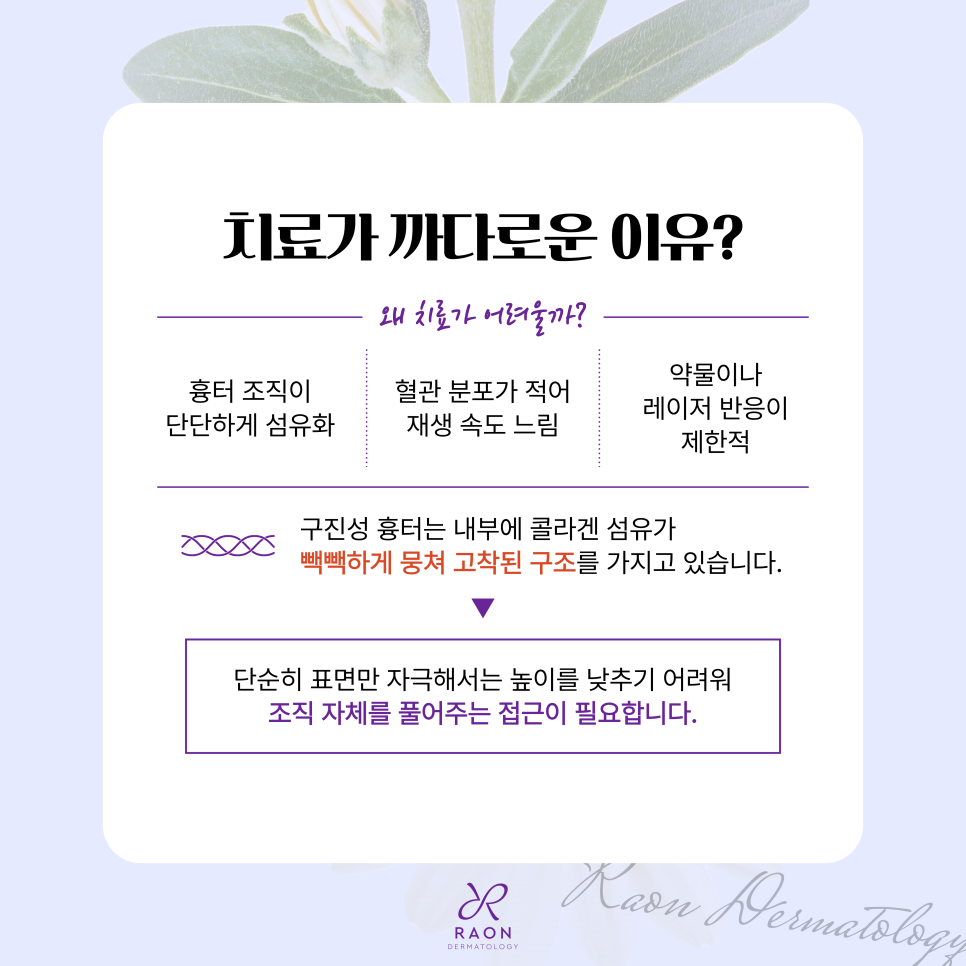 왕십리 피부과 포텐자 고주파를 이용한 원데이 구진성 흉터 치료 관련 이미지 3