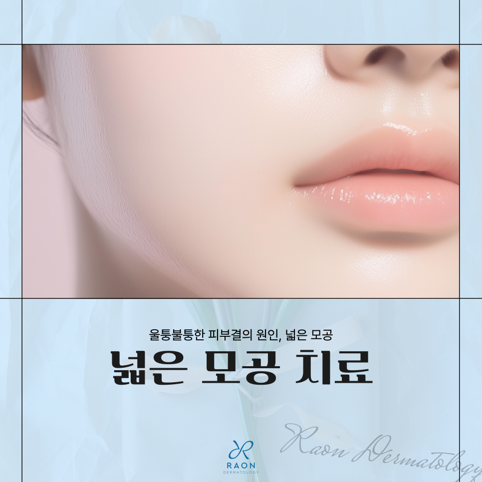 한양대역 피부과 전문의 넓어진 모공 치료를 위한 3가지 방법 관련 이미지 1