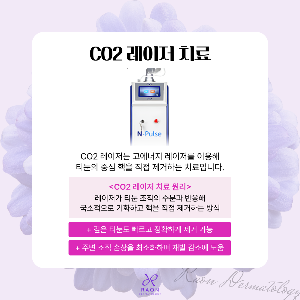 금호동 피부과 전문의 겨울철 티눈 치료는 이렇게, 더 효과적인 치료 방법은? 관련 이미지 5