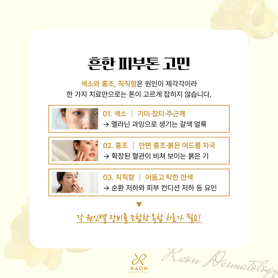왕십리 피부과 오푸스와 헐리우드 스펙트라 포함 기미 잡티 홍조 복합 레이저 관련 이미지 2