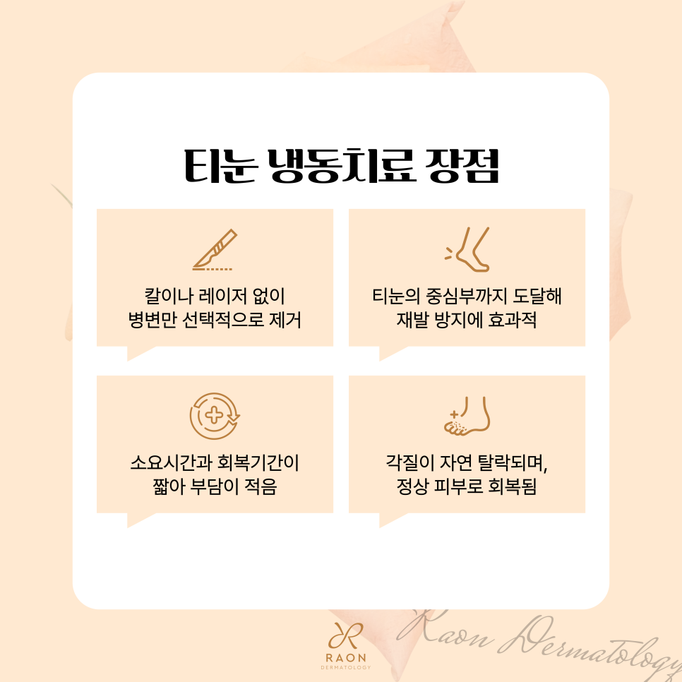 성동구 피부과 전문의의 티눈 냉동치료, 제거 후 관리방법은? 관련 이미지 5