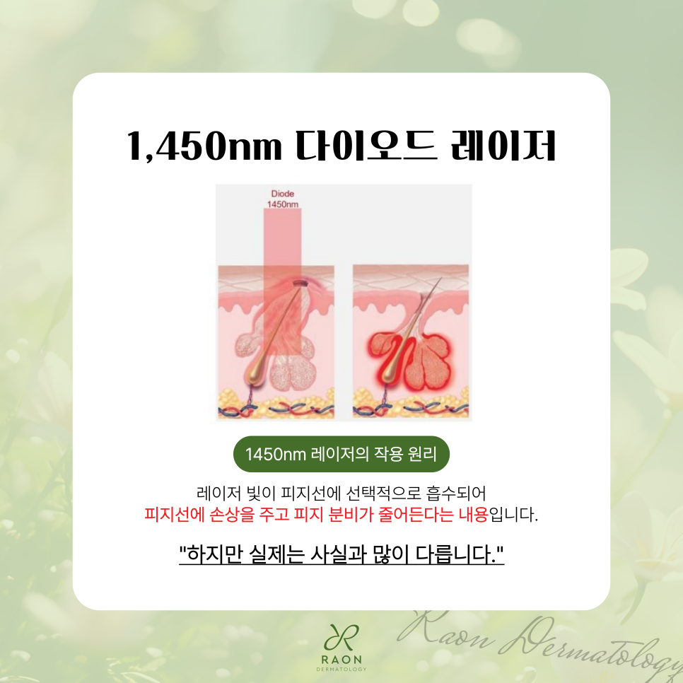 Chief Director’s Skin Column｜What Are the Limitations of Acne Laser Treatment at a Dermatology Clinic in Haengdang-dong? image 4