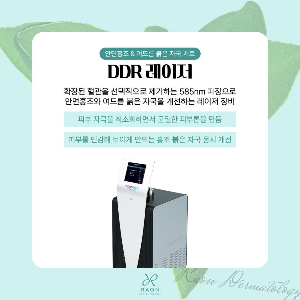 성동구 피부과 여름철 안면홍조 & 색소침착 치료 레이저, 여드름 붉은기까지 관련 이미지 6
