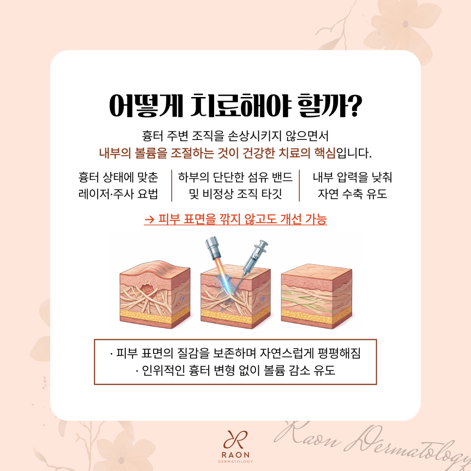 Seongdong-gu Dermatology: Is Shaving-Off Treatment the Only Answer for Papular Scars and Hypertrophic Scars? [Chief Director Skin Column] image 4