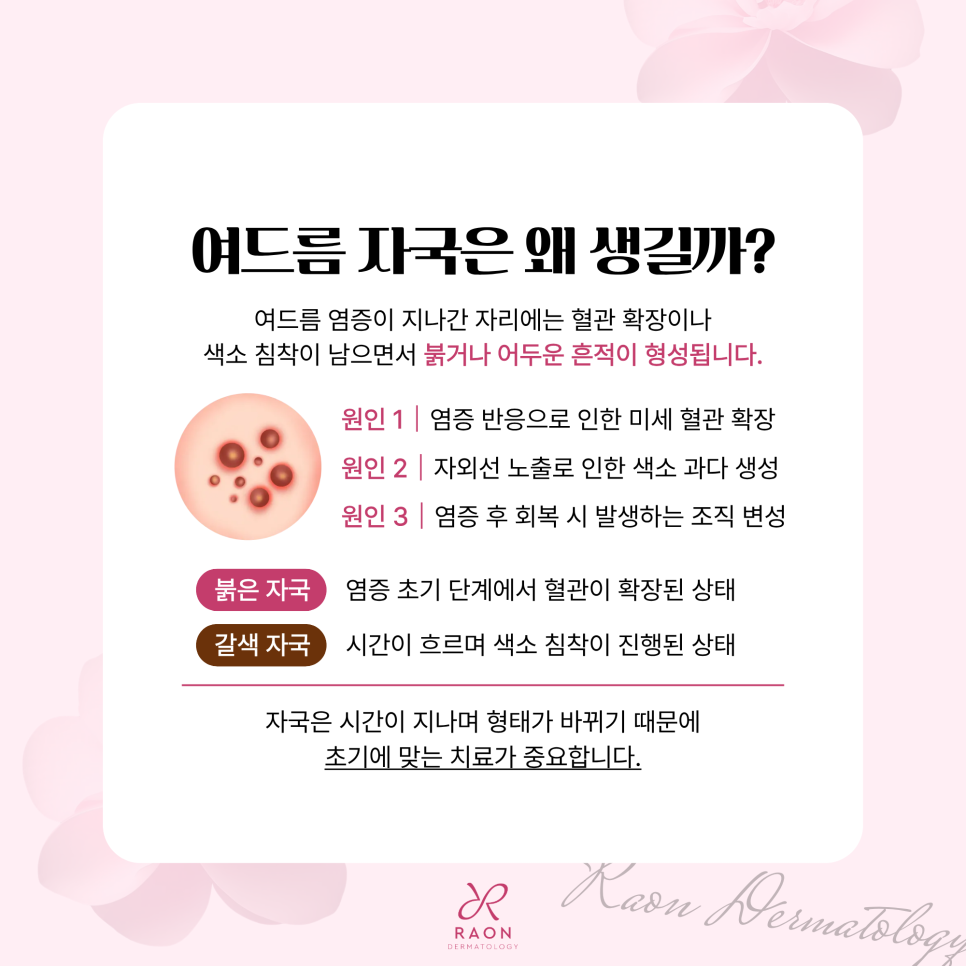 Gangdong-dong Dermatology Specialist Acne Inflammation Mark Treatment Preview, Including Laser Treatment image 2