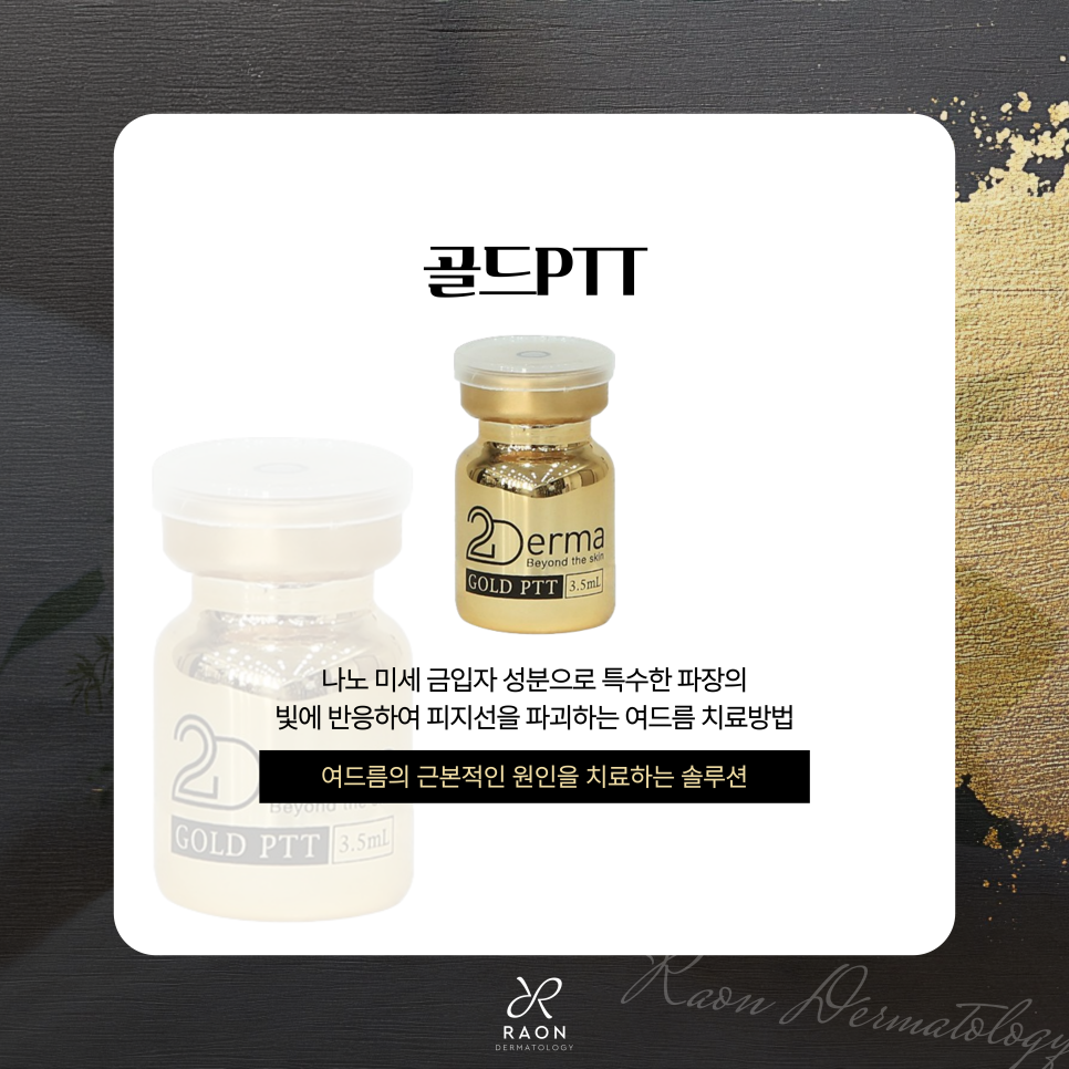 왕십리 피부과 여드름 속부터 치료하는 골드 PTT & 블랙필 효과는 관련 이미지 2