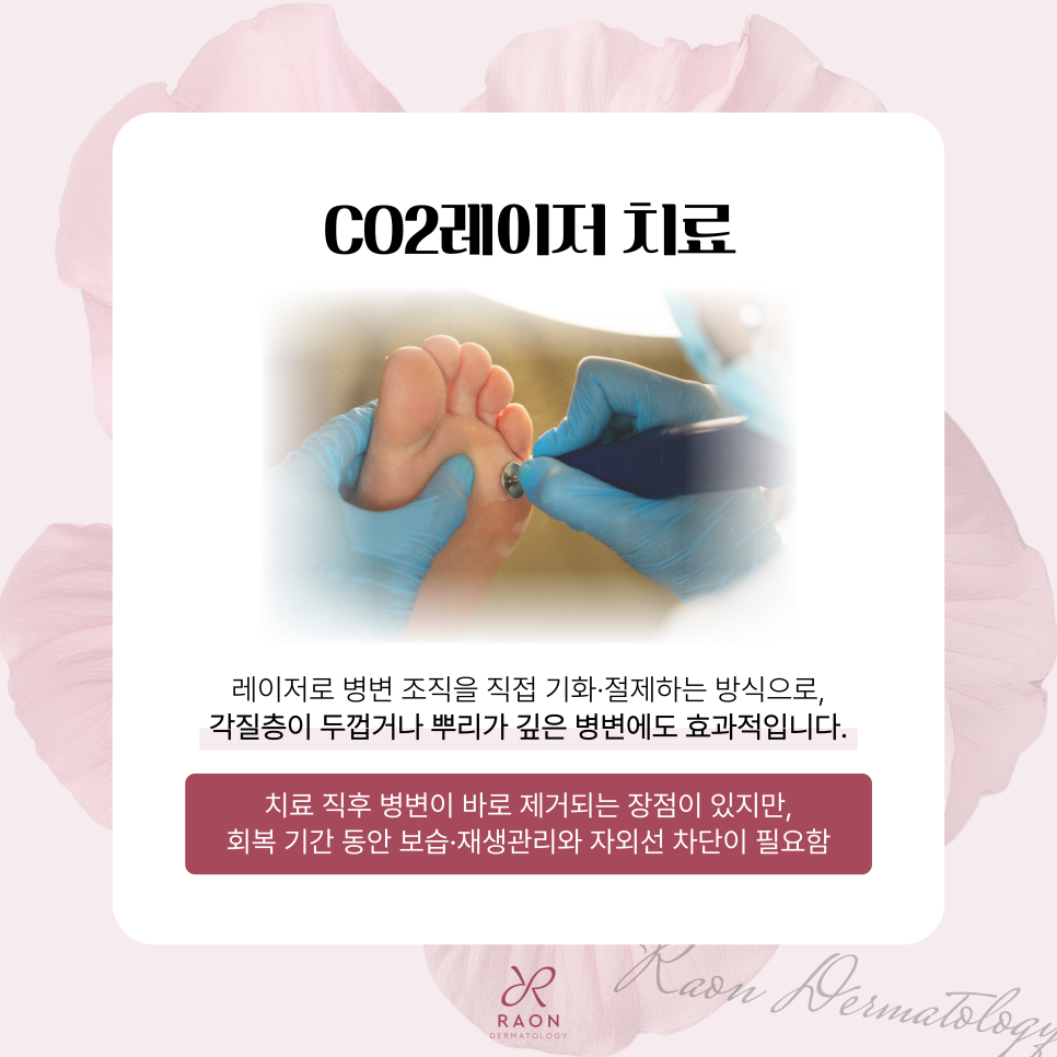Improving Warts, Corns, and Other Epidermal Lesions with Cryotherapy and CO2 Laser at a Dermatology Clinic in Haengdang-dong image 6