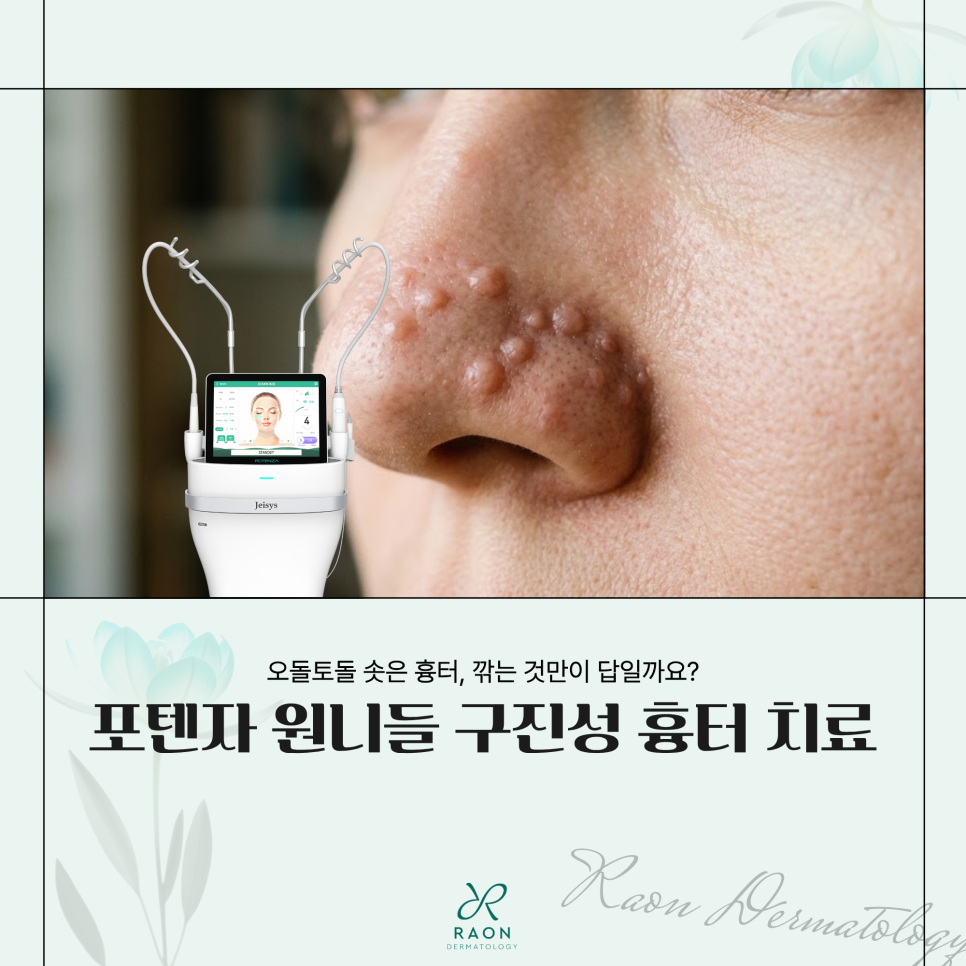 왕십리 피부과 포텐자 원니들 구진성 흉터 및 비후성 반흔 치료는 뭐가 다를까? 관련 이미지 1