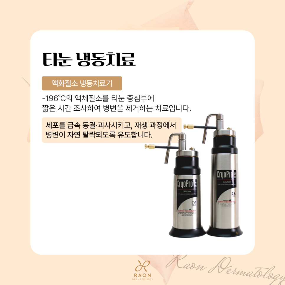 성동구 피부과 전문의의 티눈 냉동치료, 제거 후 관리방법은? 관련 이미지 4
