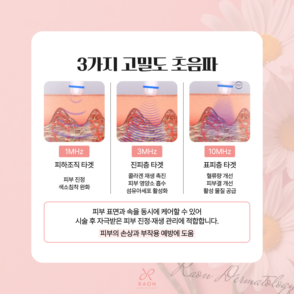 금호동 피부과 치료 만큼이나 중요한 진정재생관리 인텐스 울트라 관련 이미지 3