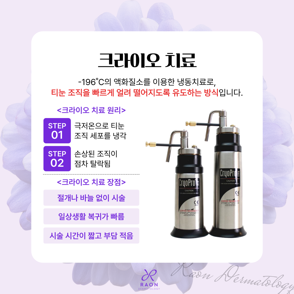 금호동 피부과 전문의 겨울철 티눈 치료는 이렇게, 더 효과적인 치료 방법은? 관련 이미지 4