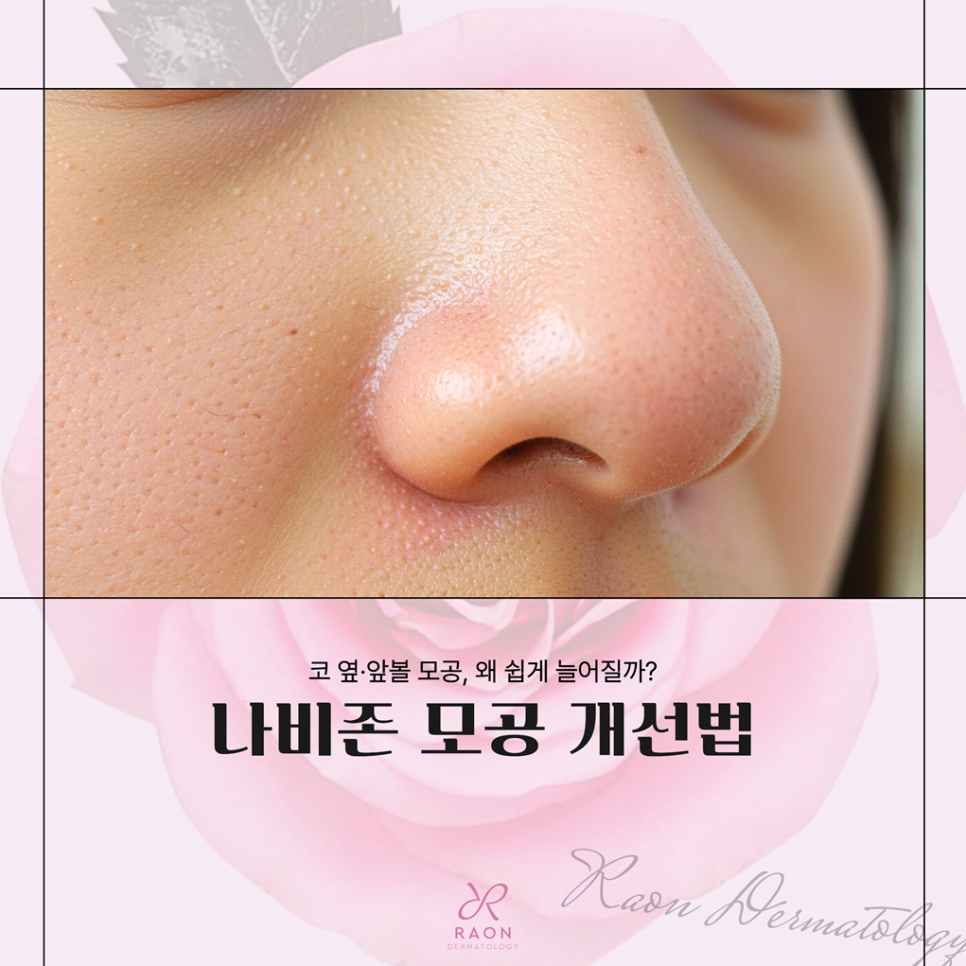 Wangsimni Station Dermatology: Why Do Butterfly Zone Pores Easily Stretch, and How Can It Be Fixed? image 1