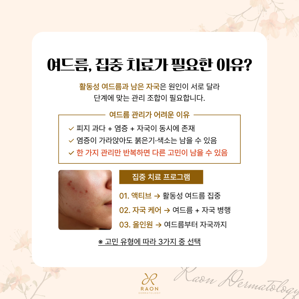 성동구 피부과 전문의 3가지 여드름 및 여드름 자국 집중 치료 과정 미리보기 관련 이미지 2