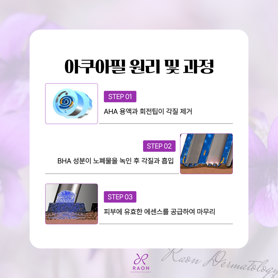 Recommended Dermatology Clinic in Wangsimni: Cleaning Skin Impurities Without Irritation with Aquapeel image 5