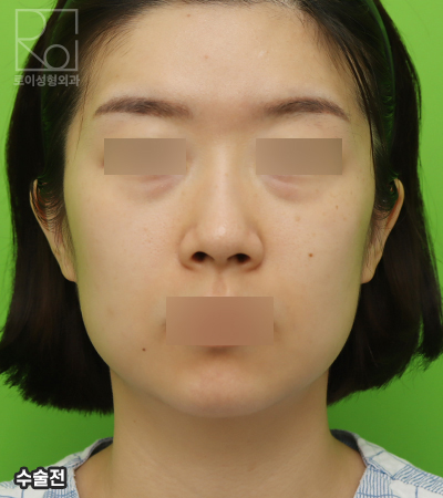 미니거상술, 효과없는 사람들의 공통점 관련 이미지 2