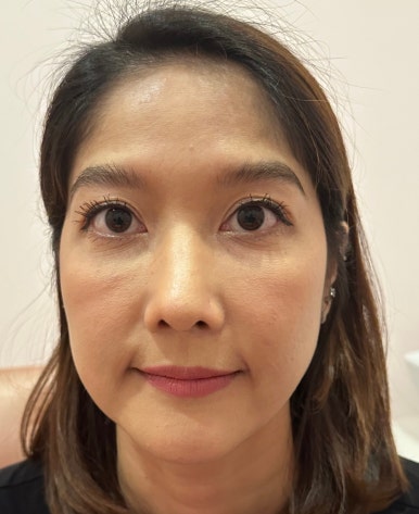 매부리코성형비용, 상담실장이 보면 싫어할 양심 선언 관련 이미지 6