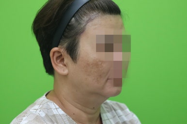 이중턱살, 설마 아직도 지방인줄 알고 계셨나요? 관련 이미지 5