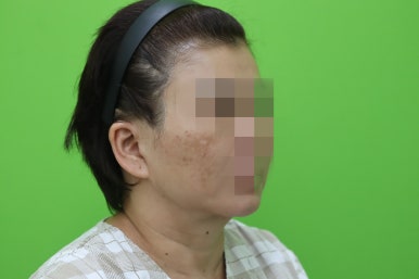 이중턱살, 설마 아직도 지방인줄 알고 계셨나요? 관련 이미지 6