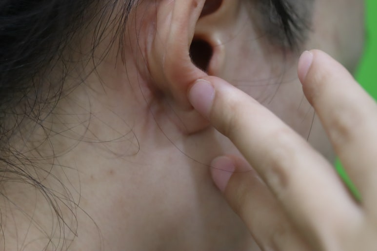 몸은 말랐는데 이중턱살제거가 시급할 때? 관련 이미지 28