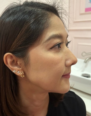 매부리코성형비용, 상담실장이 보면 싫어할 양심 선언 관련 이미지 4