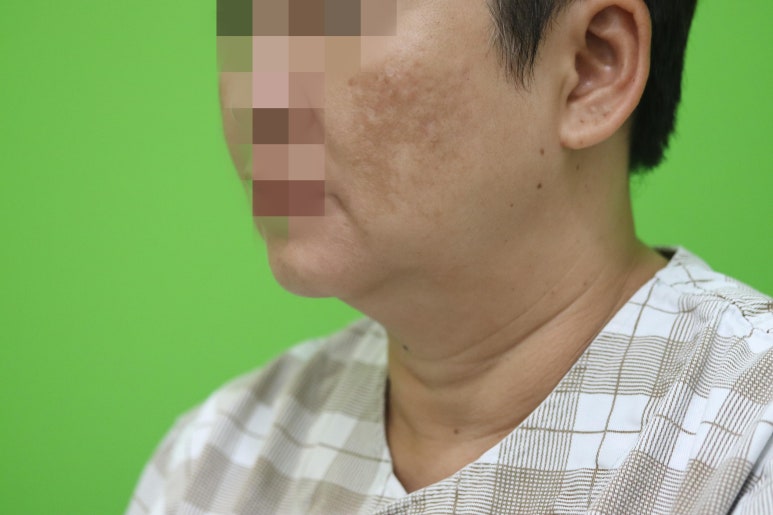 이중턱살, 설마 아직도 지방인줄 알고 계셨나요? 관련 이미지 2