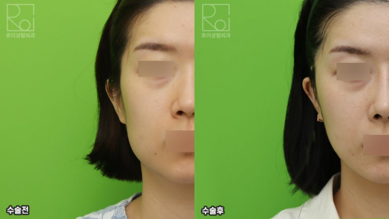 미니거상술, 효과없는 사람들의 공통점 관련 이미지 12