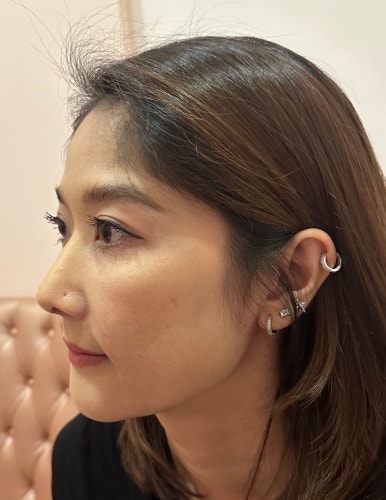 매부리코성형비용, 상담실장이 보면 싫어할 양심 선언 관련 이미지 8