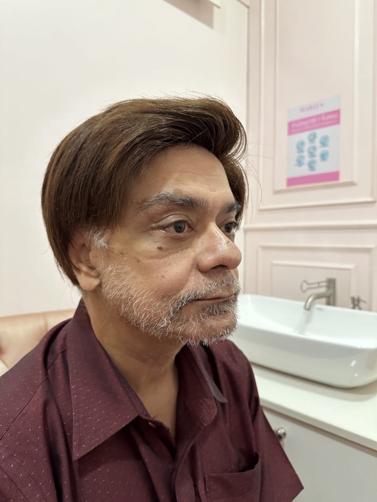 Facelift Review: Why the Neck Lift Technique Matters image 11