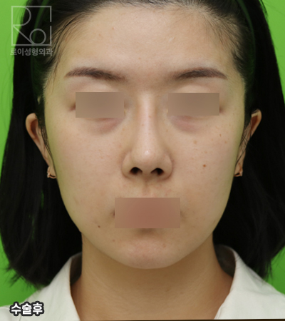 미니거상술, 효과없는 사람들의 공통점 관련 이미지 6