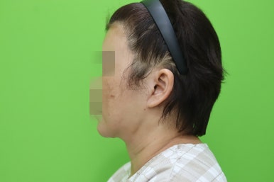 이중턱살, 설마 아직도 지방인줄 알고 계셨나요? 관련 이미지 10